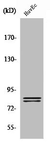 Western Blot analysis of HuvEc cells using HSL Polyclonal Antibody Western Blot analysis of HuvEc cells using HSL Polyclonal Antibody
