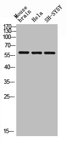 Western blot analysis of mouse-brain HELA SH-SY5Y lysis using Arylsulfatase E antibody. Western blot analysis of mouse-brain HELA SH-SY5Y lysis using Arylsulfatase E antibody.