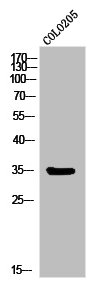 Western Blot analysis of COLO205 cells using MC1-R Polyclonal Antibody Western Blot analysis of COLO205 cells using MC1-R Polyclonal Antibody