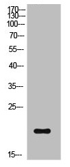 Western Blot analysis of NIH-3T3 cells using Phospho-Cofilin (S3) Polyclonal Antibody Western Blot analysis of NIH-3T3 cells using Phospho-Cofilin (S3) Polyclonal Antibody