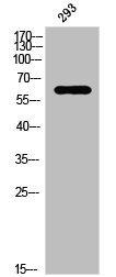 Western Blot analysis of 293 cells using Phospho-PAKalpha (T212) Polyclonal Antibody Western Blot analysis of 293 cells using Phospho-PAKalpha (T212) Polyclonal Antibody