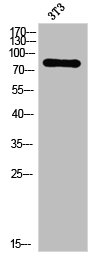 Western Blot analysis of 3T3 cells using PKC delta Polyclonal Antibody Western Blot analysis of 3T3 cells using PKC delta Polyclonal Antibody