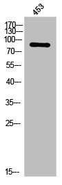 Western Blot analysis of 453 cells using PKC epsilon Polyclonal Antibody Western Blot analysis of 453 cells using PKC epsilon Polyclonal Antibody