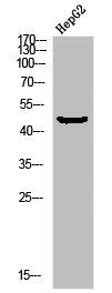 Western blot analysis of HEPG2-UV using p-MEK-1 (S298) antibody. Western blot analysis of HEPG2-UV using p-MEK-1 (S298) antibody.