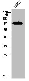 Western Blot analysis of 22RV1 cells using SphK2 Polyclonal Antibody Western Blot analysis of 22RV1 cells using SphK2 Polyclonal Antibody