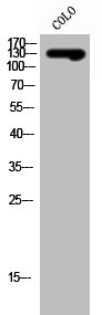 Western Blot analysis of COLO cells using SLC4A8/10 Polyclonal Antibody