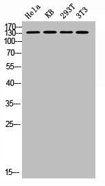 Western blot analysis of HELA KB 293T 3T3 lysis using Phospho-FAK (S843) antibody.