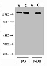 Western blot analysis of customers lysis using Phospho-FAK (S843) antibody. Western blot analysis of customers lysis using Phospho-FAK (S843) antibody.