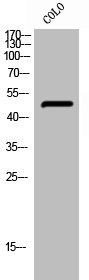 Western Blotting(WB) 1- Phospho-PTPN1 (S50) Antibody
