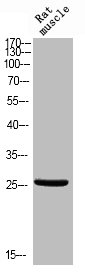 Western blot analysis of RAT-MUSLE using Phospho-Bcl-x (T47) antibody. Western blot analysis of RAT-MUSLE using Phospho-Bcl-x (T47) antibody.