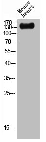 Western blot analysis of mouse-heart lysis using Plakophilin 4 antibody. Western blot analysis of mouse-heart lysis using Plakophilin 4 antibody.