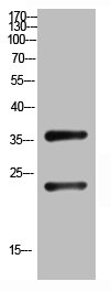 Western Blot analysis of customers (cat sample) using QM Polyclonal Antibody.
