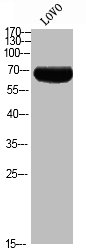 Western blot analysis of LOVO using p-p70 S6 kinase alpha (T444) antibody. Western blot analysis of LOVO using p-p70 S6 kinase alpha (T444) antibody.