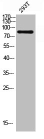 Western blot analysis of 293T lysis using COP1 antibody. Western blot analysis of 293T lysis using COP1 antibody.