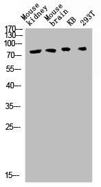 Western blot analysis of mouse-kidney mouse-brain KB 293T lysis using TBX3 antibody.