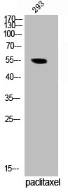Western Blot analysis of 293 cells using Phospho-TRF1 (S219) Polyclonal Antibody Western Blot analysis of 293 cells using Phospho-TRF1 (S219) Polyclonal Antibody