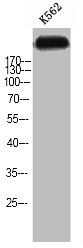 Western Blot analysis of K562 cells using Tensin-1 Polyclonal Antibody Western Blot analysis of K562 cells using Tensin-1 Polyclonal Antibody