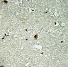Immunohistochemistry of paraffin-embedded human brain using CSB-PA060029 at dilution of 1:100