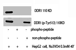 Western Blotting(WB) 1- DDR1 Antibody
