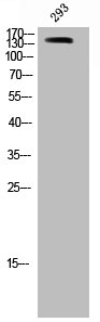 Western Blot analysis of 293 cells using SMC1 Polyclonal Antibody Western Blot analysis of 293 cells using SMC1 Polyclonal Antibody