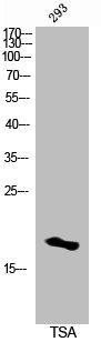 Western Blot analysis of 3T3 cells using Acetyl-Histone H3 (K14) Polyclonal Antibody Western Blot analysis of 3T3 cells using Acetyl-Histone H3 (K14) Polyclonal Antibody