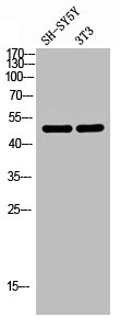 Western blot analysis of SH-SY5Y 3T3 lysis using LPAAT-theta antibody.