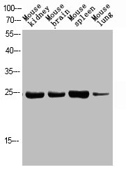 Western Blotting(WB) 1- Phospho-FADD (S194) Antibody