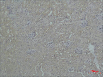 Immunohistochemical analysis of paraffin-embedded Mouse Kidney Tissue using ZBTB45 Polyclonal Antibody. Immunohistochemical analysis of paraffin-embedded Mouse Kidney Tissue using ZBTB45 Polyclonal Antibody.