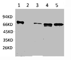 Western blot analysis of 1) Hela, 2) Jurkat, 3) Mouse Brain, 4) Mouse Kidney, 5) Rat Brain using ZBTB45 Polyclonal Antibody.