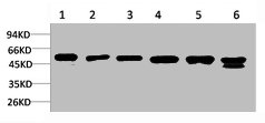 Western blot analysis of 1) A431, 2) Hela, 3) C2C12, 4) 3T3, 5) PC12, 6) Rat Brain Tissue using Smad3 Polyclonal Antibody.