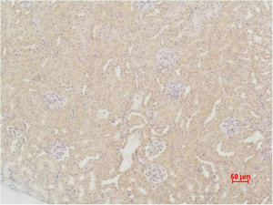 Immunohistochemical analysis of paraffin-embedded Mouse Kidney Tissue using SOD2 Polyclonal Antibody. Immunohistochemical analysis of paraffin-embedded Mouse Kidney Tissue using SOD2 Polyclonal Antibody.