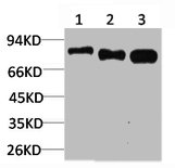 Western blot analysis of 1) Hela, 2) 3T3, 3) PC12 using p70 S6 kinase alpha Polyclonal Antibody.