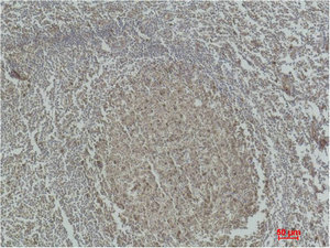Immunohistochemical analysis of paraffin-embedded Human Tonsil Tissue using Caspase-3 Polyclonal Antibody. Immunohistochemical analysis of paraffin-embedded Human Tonsil Tissue using Caspase-3 Polyclonal Antibody.