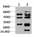 Western Blotting(WB) 1- TGFB1 Antibody
