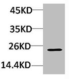 Western blot analysis of Hela using Crystallin-alphaC Polyclonal Antibody. Western blot analysis of Hela using Crystallin-alphaC Polyclonal Antibody.