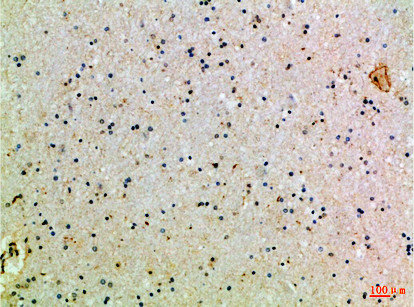 Immunohistochemical analysis of paraffin-embedded Human-brain, antibody was diluted at 1:100