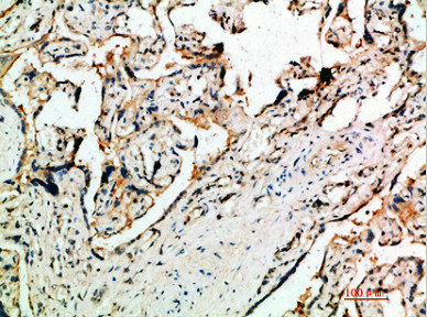 Immunohistochemical analysis of paraffin-embedded human-placenta, antibody was diluted at 1:200
