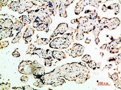 Immunohistochemical analysis of paraffin-embedded human-placenta, antibody was diluted at 1:200