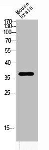 Western blot analysis of MOUSE-BRAIN lysis using ART1 antibody. Antibody was diluted at 1:2000. Secondary antibody was diluted at 1:20000 Western blot analysis of MOUSE-BRAIN lysis using ART1 antibody. Antibody was diluted at 1:2000. Secondary antibody was diluted at 1:20000