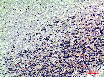 Immunohistochemical analysis of paraffin-embedded human-brain, antibody was diluted at 1:200