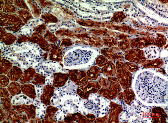 Immunohistochemical analysis of paraffin-embedded human-kidney, antibody was diluted at 1:200