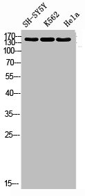Western blot analysis of SH-SY5Y K562 HELA using RNase III Drosha antibody. Antibody was diluted at 1:1000. Secondary antibody was diluted at 1:20000