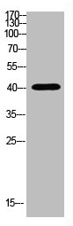 Western Blotting(WB) 1- HLA-A Antibody