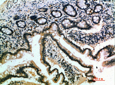 Immunohistochemical analysis of paraffin-embedded human-small-intestine, antibody was diluted at 1:200