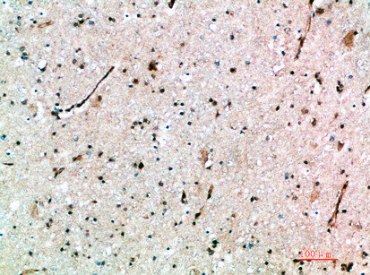 Immunohistochemical analysis of paraffin-embedded human-brain, antibody was diluted at 1:200 Immunohistochemical analysis of paraffin-embedded human-brain, antibody was diluted at 1:200