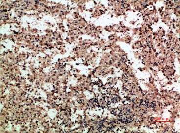 Immunohistochemical analysis of paraffin-embedded human-spleen, antibody was diluted at 1:200 Immunohistochemical analysis of paraffin-embedded human-spleen, antibody was diluted at 1:200