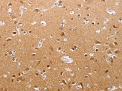 The image on the left is immunohistochemistry of paraffin-embedded Human brain tissue using CSB-PA023267(PFN2 Antibody) at dilution 1/30, on the right is treated with synthetic peptide. (Original magnification: x200) The image on the left is immunohistochemistry of paraffin-embedded Human brain tissue using CSB-PA023267(PFN2 Antibody) at dilution 1/30, on the right is treated with synthetic peptide. (Original magnification: x200)