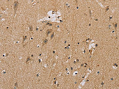 The image on the left is immunohistochemistry of paraffin-embedded Human brain tissue using CSB-PA026004(MTUS1 Antibody) at dilution 1/20, on the right is treated with fusion protein. (Original magnification: x200)