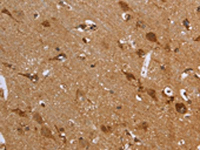 The image on the left is immunohistochemistry of paraffin-embedded Human brain tissue using CSB-PA045962(FH Antibody) at dilution 1/30, on the right is treated with fusion protein. (Original magnification: x200)