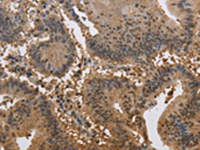 CSB-PA049990